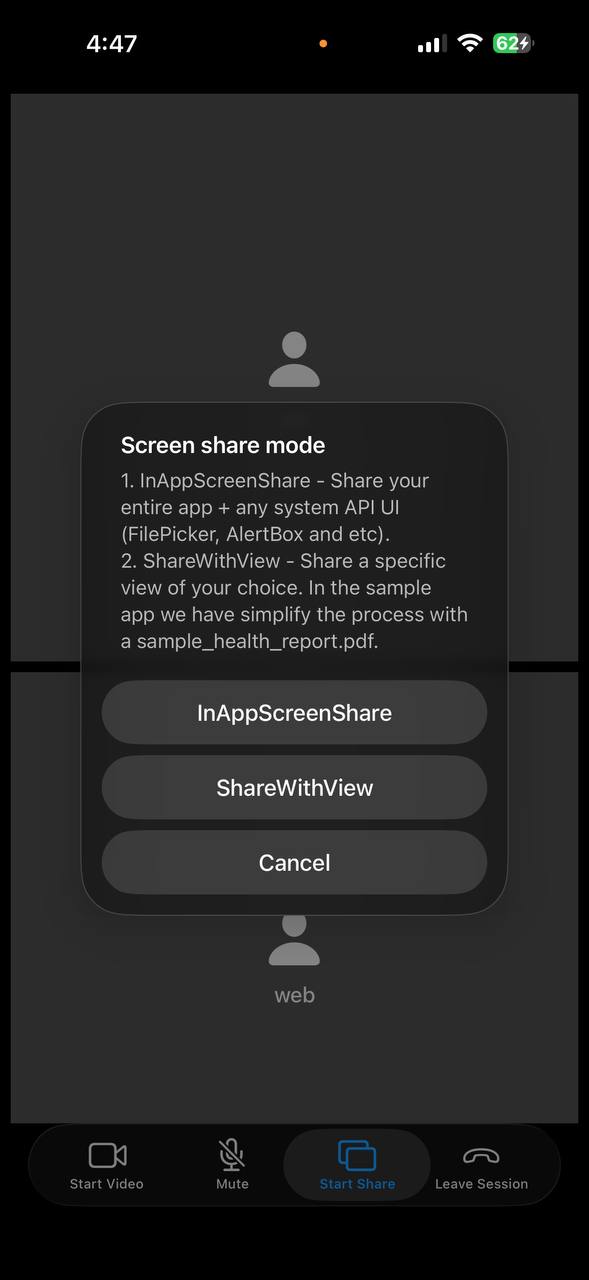 Share Options